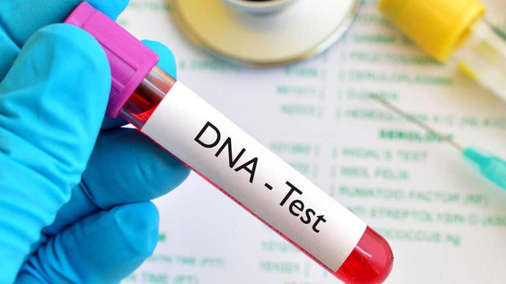 DNA Testing