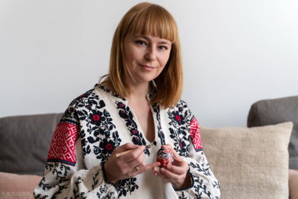 Celebrities with Noonan Syndrome